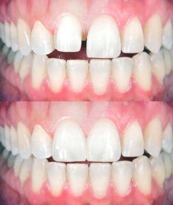 ricostruzioni dentali studio yari basente sassari