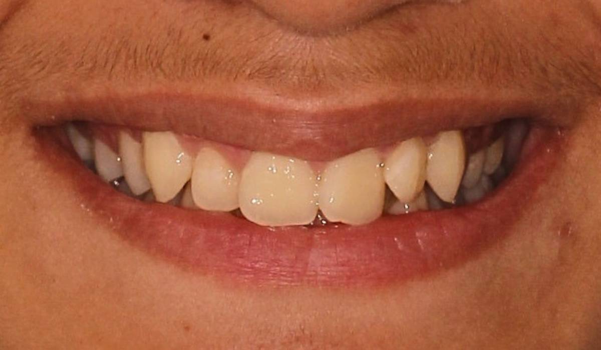1 1